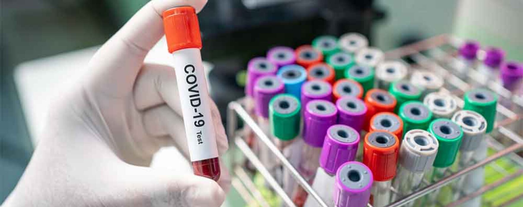 Dâmboviţa: Doar 1.000 de teste făcute pentru coronavirus (4 mai)